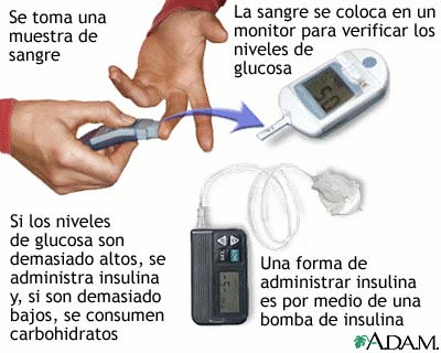 nivelesglucosa